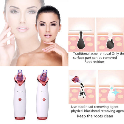 USB Rechargeable Blackhead Remover Vacuum